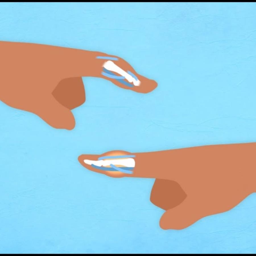 What is a Jammed Finger?