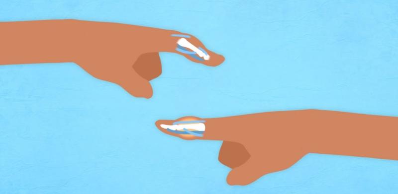 What is a Jammed Finger?